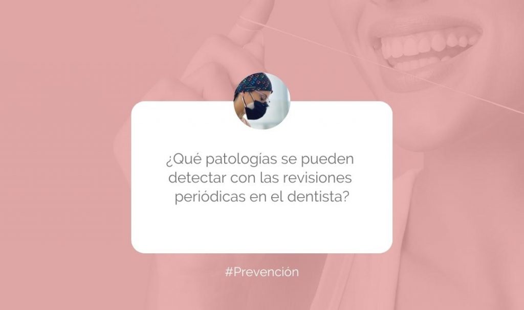 Revisión dental